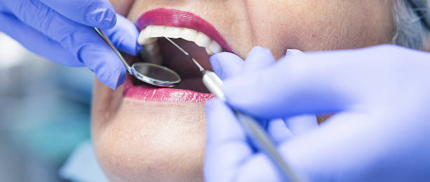 Best Emergency Dentist for Special Needs Patients in Divernon, IL